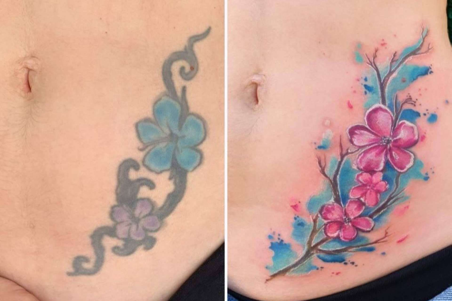 Eliminar tatuajes sin láser con Laura Caselles